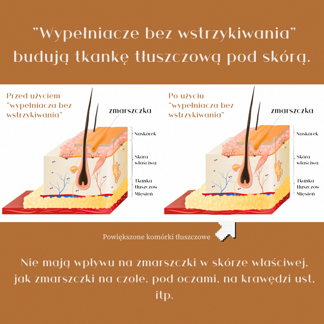 Volufiline, Voluplus, Adipofil - na jakie zmarszczki?